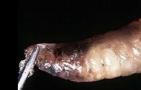 蜜蜂囊状幼虫病是什么病？